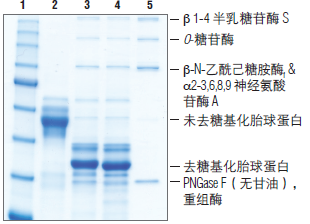蛋白去糖基化混合液II--NEB酶试剂 New England Biolabs