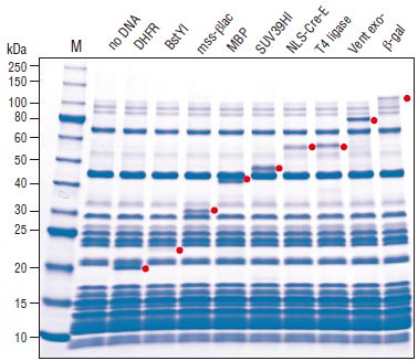 E. coli 核糖体--NEB酶试剂 New England Biolabs