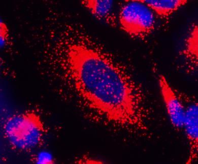 Cell Navigator溶酶体标记试剂盒  货号：22658