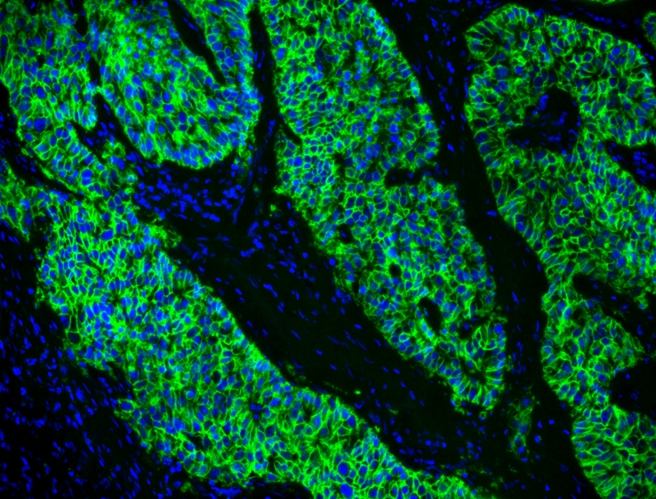 FluoroQuest 防褪色固定介质（含DAPI）  货号：20005