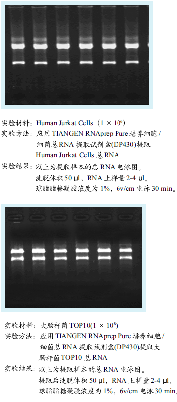 天根培养细胞细jun总RNAti取试剂盒 50次