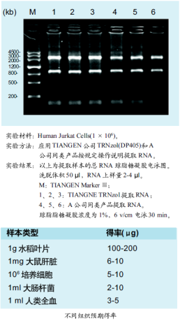 天根TRNzol总RNAti取试剂(DP405) 100ml